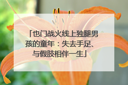 也门战火线上独腿男孩的童年：失去手足、与假肢相伴一生